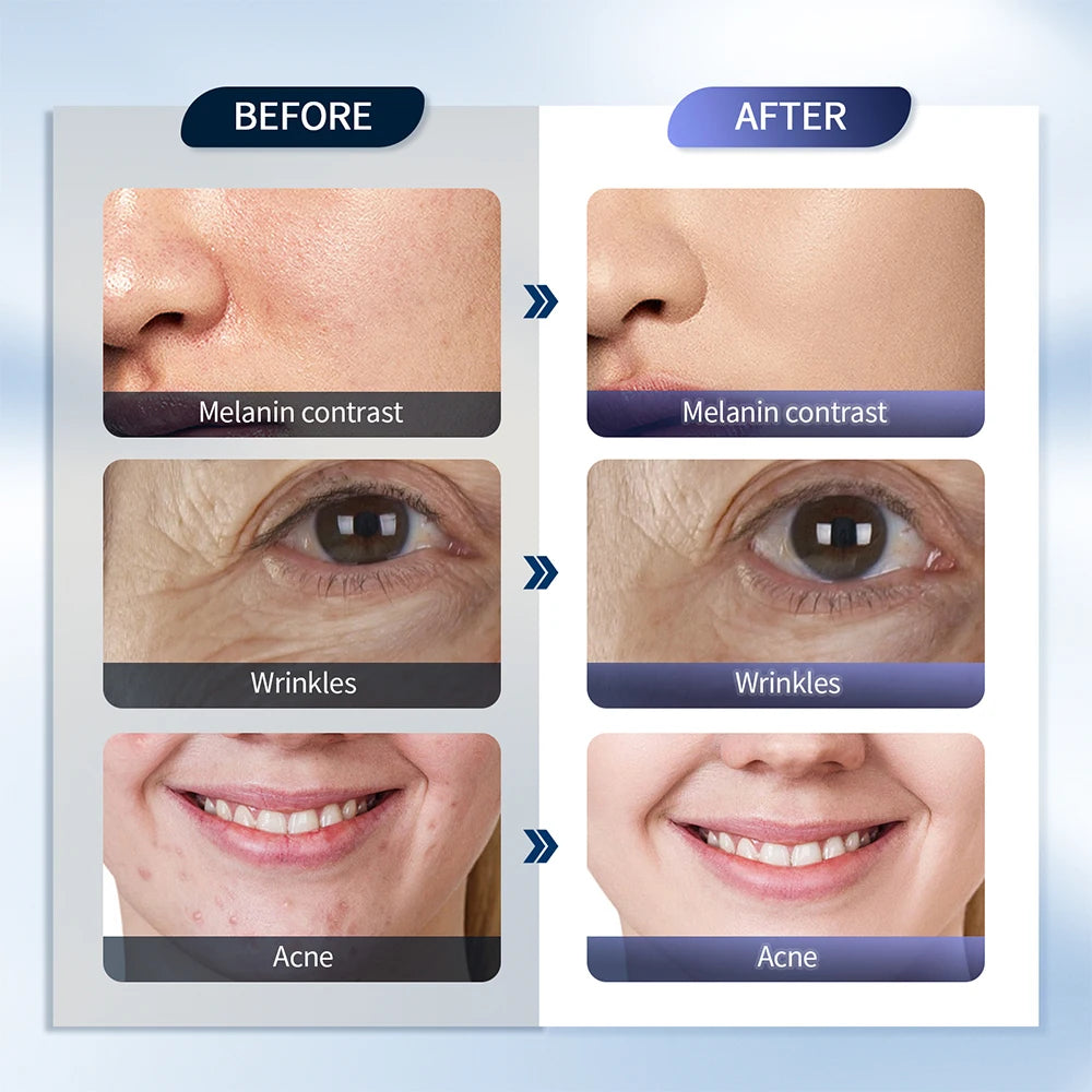 Rejuvenation LED Photon Face Mask