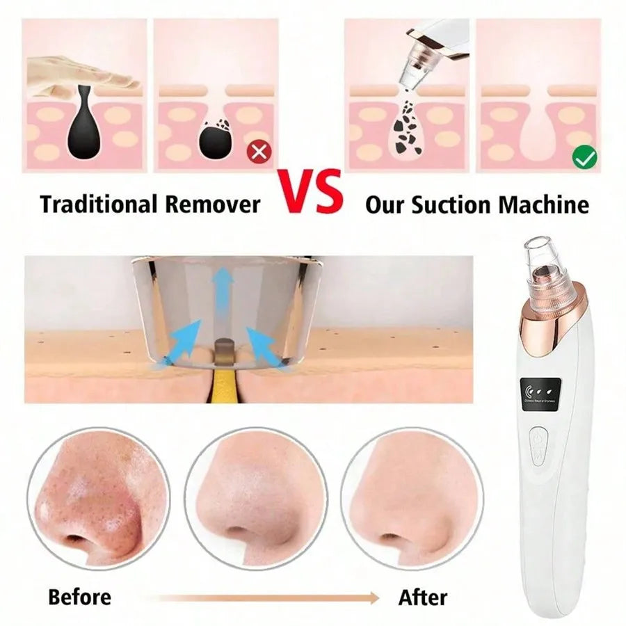 Blackhead Remover Vacuum Cleaner