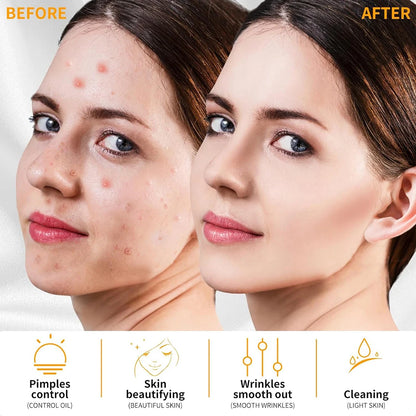 Skin Tightening Neon Facial Massage