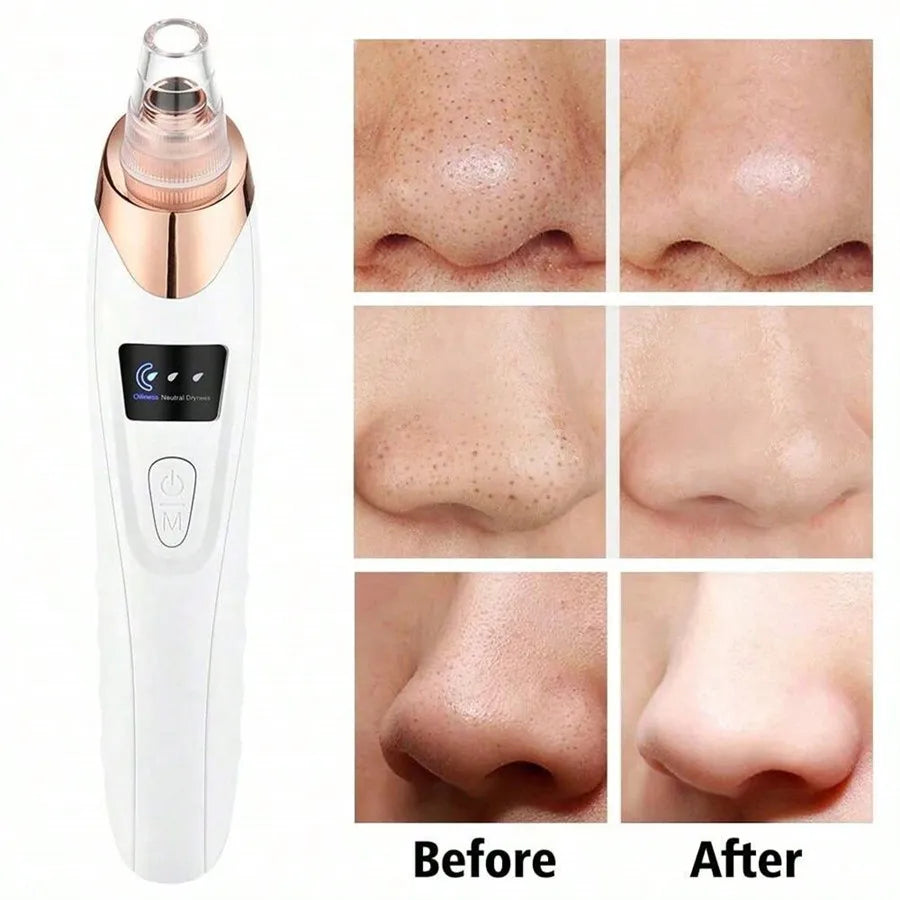 Blackhead Remover Vacuum Cleaner