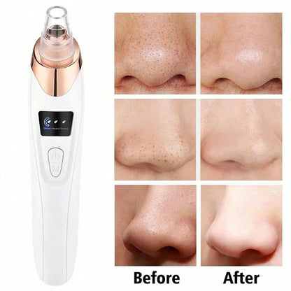 Blackhead Remover Vacuum Cleaner