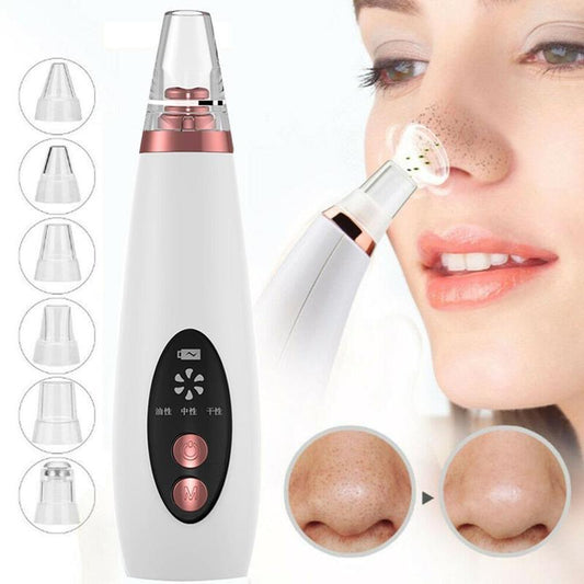 Blackhead pore vacuum cleaner removing blackheads and cleansing pores for smooth, rejuvenated skin.
